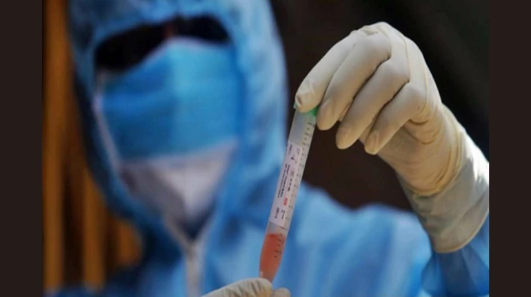 मुंबईत हॉटस्पॉटमध्ये रक्ताचे नमुने घेण्यासाठी राष्ट्रीय सेरो सर्वेक्षण मुंबईत हॉटस्पॉटमध्ये रक्ताचे नमुने घेण्यासाठी राष्ट्रीय सेरो सर्वेक्षण