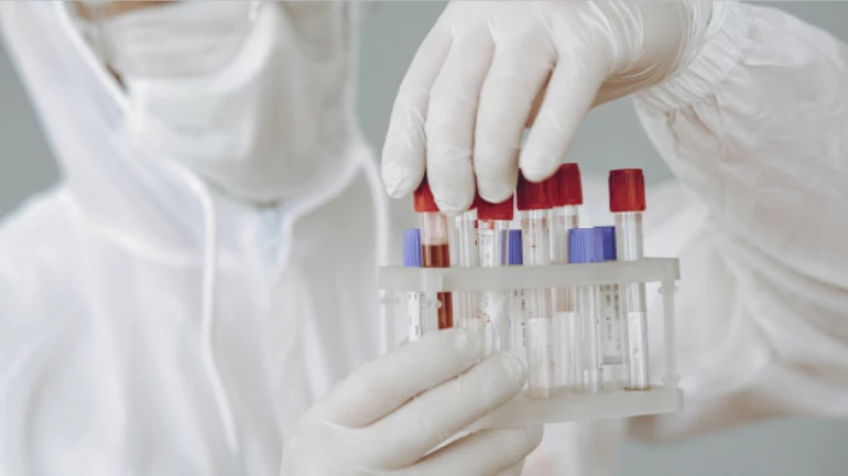 टास्क फोर्सची पालिकेकडे कोरोना चाचण्या वाढवण्याची मागणी टास्क फोर्सची पालिकेकडे कोरोना चाचण्या वाढवण्याची मागणी