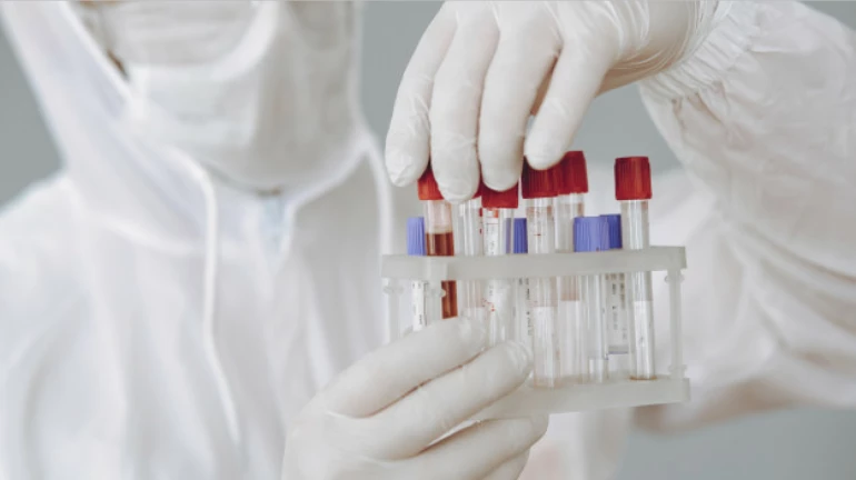 कोरोनाचा कहर ! दिवसभरात ३६४ जणांचा मृत्यू, १२ हजार ६०८ नवे रुग्ण कोरोनाचा कहर ! दिवसभरात ३६४ जणांचा मृत्यू, १२ हजार ६०८ नवे रुग्ण