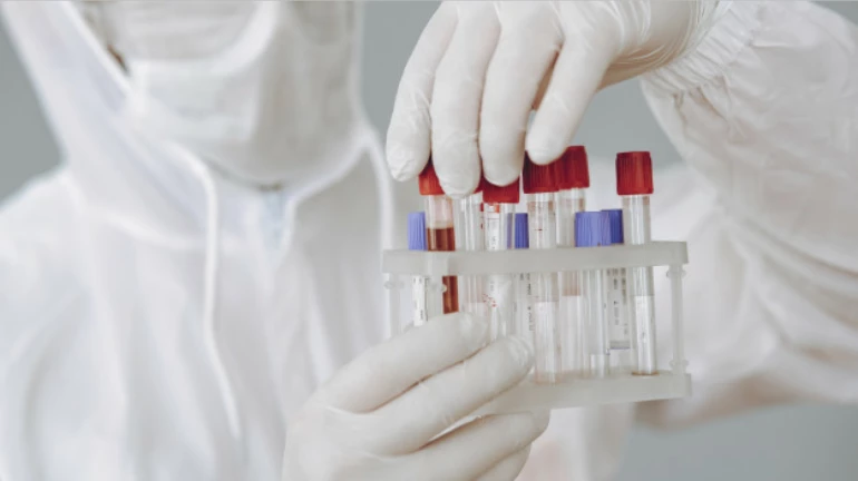 BMC to start free tests at 244 locations BMC to start free tests at 244 locations