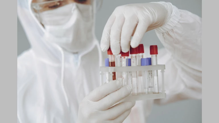 मीरा-भायंदर में गुरुवार को COVID-19 के 221 नए केस, 4 की मौत मीरा-भायंदर में गुरुवार को COVID-19 के 221 नए केस, 4 की मौत