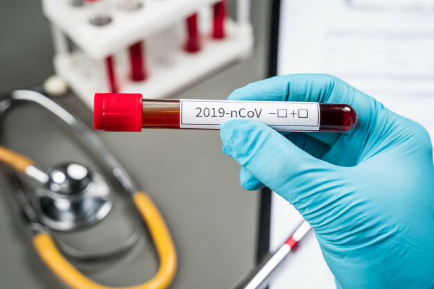 प्लाझ्मा थेरपी ट्रायल केंद्राचं उद्घाटन, मुख्यमंत्र्यांनी केलं प्लाझ्मा दान करण्याचं आवाहन