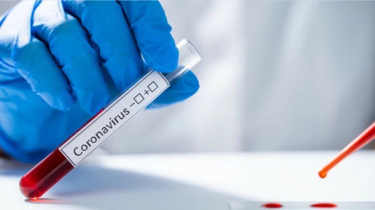 बिना डॉक्टर की पर्ची के आज से मुंबई में कोरोना का परीक्षण बिना डॉक्टर की पर्ची के आज से मुंबई में कोरोना का परीक्षण