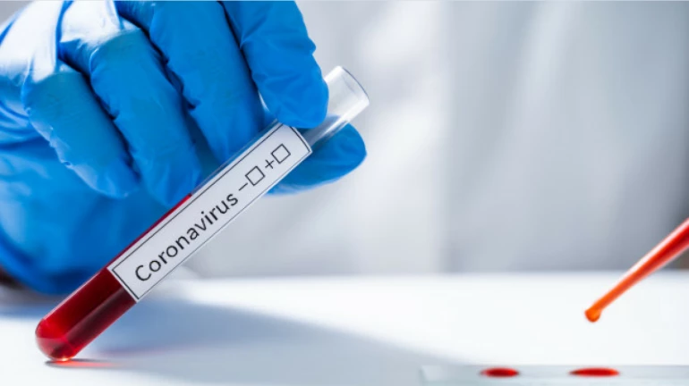 ठाण्यात रुग्ण बरे होण्याचं प्रमाण वाढलं, 'इतके' रुग्ण आतापर्यंत बरे ठाण्यात रुग्ण बरे होण्याचं प्रमाण वाढलं, 'इतके' रुग्ण आतापर्यंत बरे