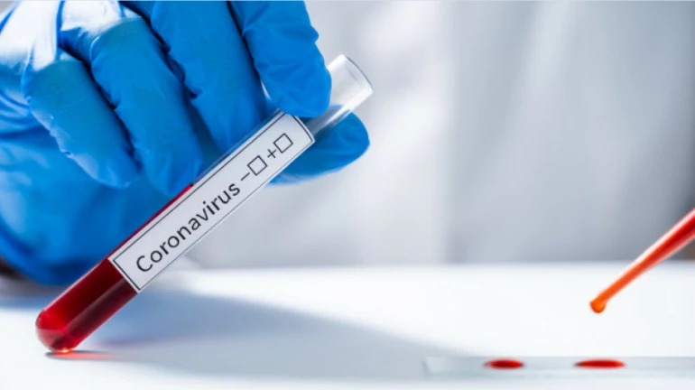 Mira-Bhayandar MLA Geeta Jain tests positive for COVID-19 Mira-Bhayandar MLA Geeta Jain tests positive for COVID-19