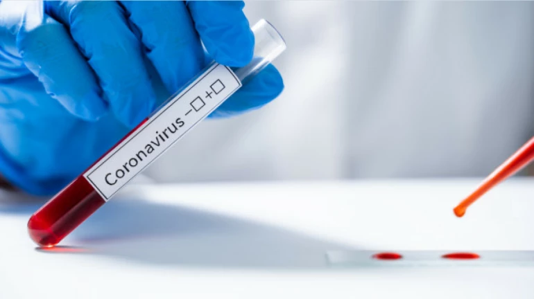 Maharashtra ranks in top 3 states with most COVID-19 tests Maharashtra ranks in top 3 states with most COVID-19 tests