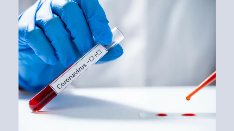 Navi Mumbai Registers 376 New Coronavirus Cases, Fatality Toll Reaches 454 In The Region