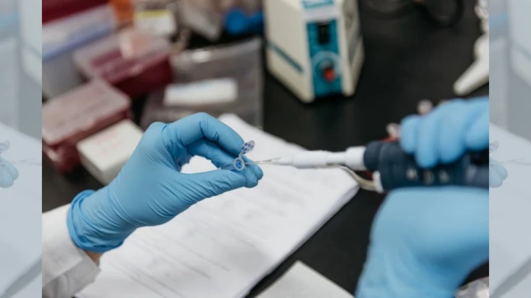 Colaba, Chembur, Goregaon, Kandivali and Andheri have the highest active coronavirus cases: BMC report Colaba, Chembur, Goregaon, Kandivali and Andheri have the highest active coronavirus cases: BMC report