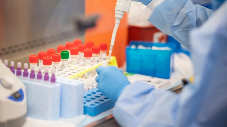 मुंबई में खार में सबसे कम है कोरोना की रफ्तार मुंबई में खार में सबसे कम है कोरोना की रफ्तार