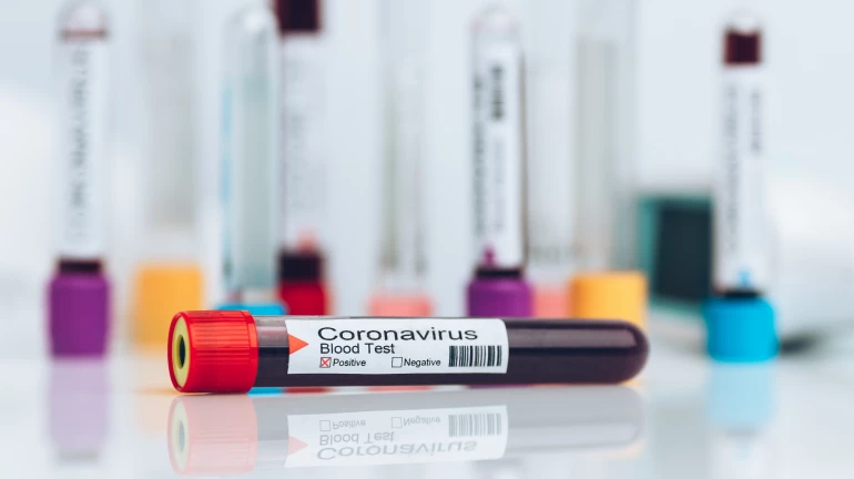 BMC Announces Completion of First-Phase of Serosurvey Among 10,000 Residents BMC Announces Completion of First-Phase of Serosurvey Among 10,000 Residents