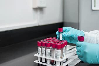 BMC begins testing staffers with Rapid Antigen Testing kits