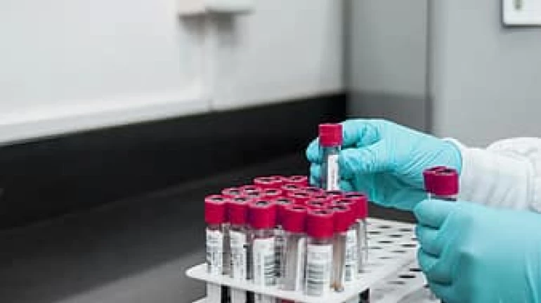 BMC begins testing staffers with Rapid Antigen Testing kits