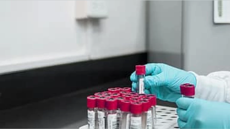 राज्यात आतापर्यंत १४ लाख ८६ हजार ९२६ कोरोनाबाधित बरे राज्यात आतापर्यंत १४ लाख ८६ हजार ९२६ कोरोनाबाधित बरे