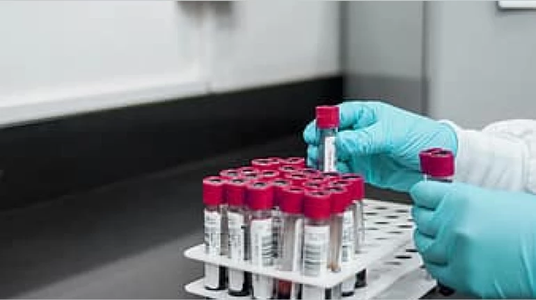 राज्यात १० हजार ४४१ नवे रुग्ण, तर २५८ जणांचा दिवसभरात मृत्यू राज्यात १० हजार ४४१ नवे रुग्ण, तर २५८ जणांचा दिवसभरात मृत्यू