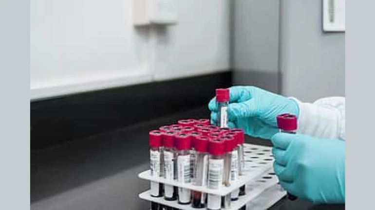 मीरा-भायंदर में गुरुवार को COVID-19 के 176 नए केस, 7 की मौत मीरा-भायंदर में गुरुवार को COVID-19 के 176 नए केस, 7 की मौत