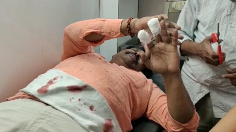 शिवसेना कल्याण उपनगर प्रमुख पर हमला शिवसेना कल्याण उपनगर प्रमुख पर हमला