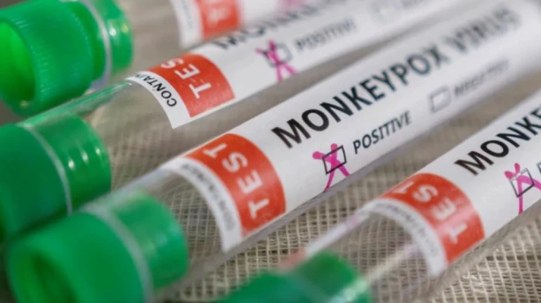 Government issues guidelines for effective management of Monkeypox