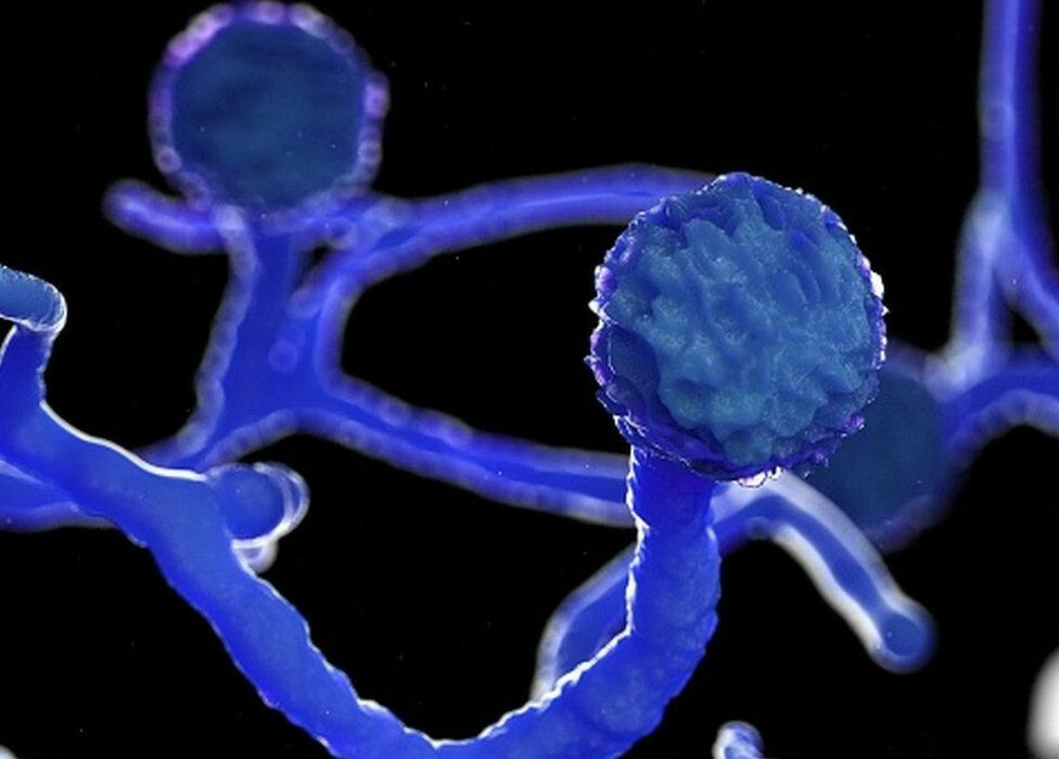 राज्य में इतने मरीज म्यूकोरिया से संक्रमित