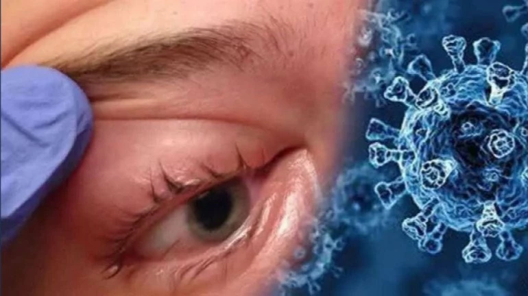 मुंबईत म्युकर मायकोसिस नियंत्रणात मुंबईत म्युकर मायकोसिस नियंत्रणात