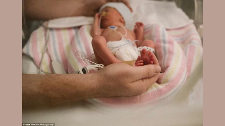 Mumbai Hospital Achieves Breakthrough in Premature Baby Survival Mumbai Hospital Achieves Breakthrough in Premature Baby Survival