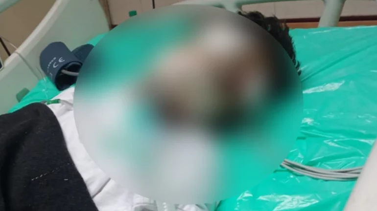 Mumbai: Man bitten by rat in ICU of Rajawadi Hospital dies
