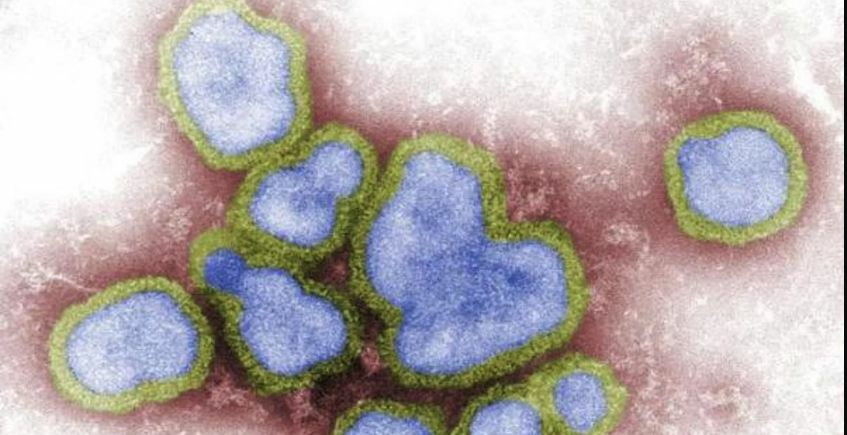 लक्षणांवरून COVID झालाय की SARI हे कसं ओळखाल?