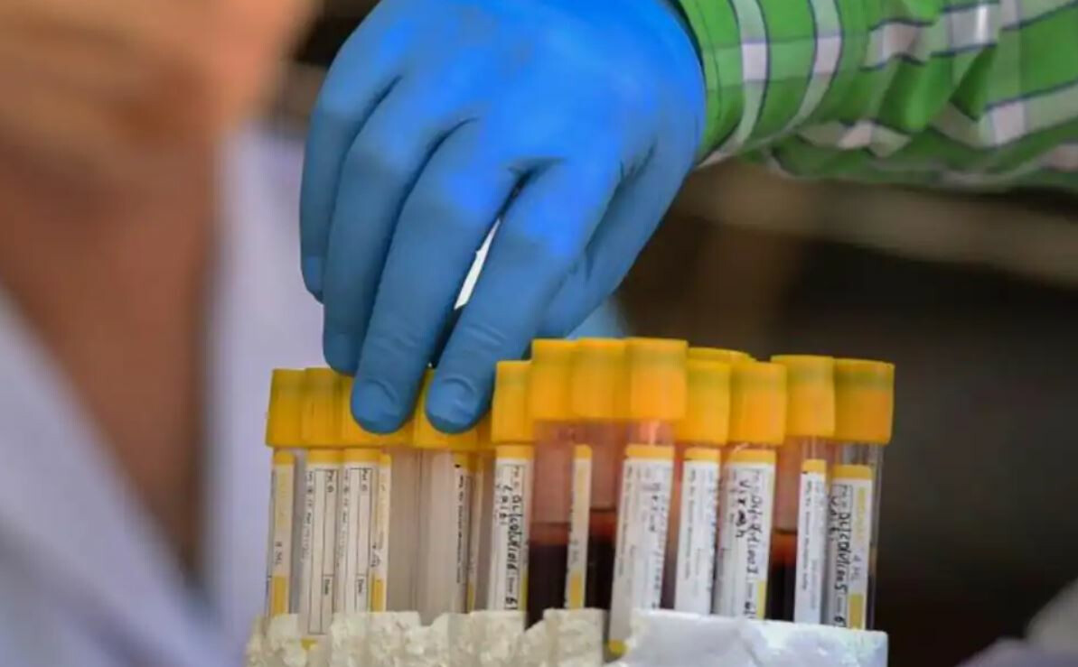 ८६.६४ टक्के मुंबईकरांमध्ये आढळल्या कोविड –१९ अँटीबॉडीज