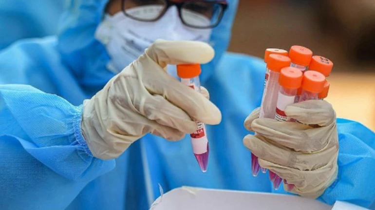 COVID-19 In Mumbai: BMC To Conduct Sero-survey Of Over 3000 Samples Till October 6 COVID-19 In Mumbai: BMC To Conduct Sero-survey Of Over 3000 Samples Till October 6