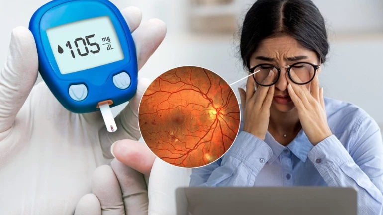 Continuous Screentime Can Lead To Computer Vision Syndrome; Here's How To Avoid It Continuous Screentime Can Lead To Computer Vision Syndrome; Here's How To Avoid It