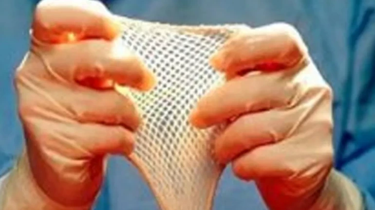 परळच्या केईएम रुग्णालयात सुरू होणार स्किन बँक परळच्या केईएम रुग्णालयात सुरू होणार स्किन बँक