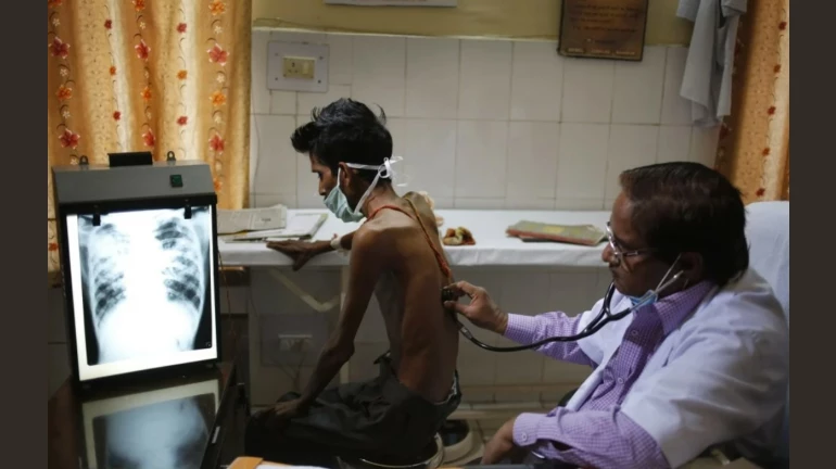 मुंबई बीएमसी सेवरी अस्पताल में टीबी रोगियों के लिए भारत का पहला पैलिएटिव केयर वार्ड शुरू करेगी मुंबई बीएमसी सेवरी अस्पताल में टीबी रोगियों के लिए भारत का पहला पैलिएटिव केयर वार्ड शुरू करेगी