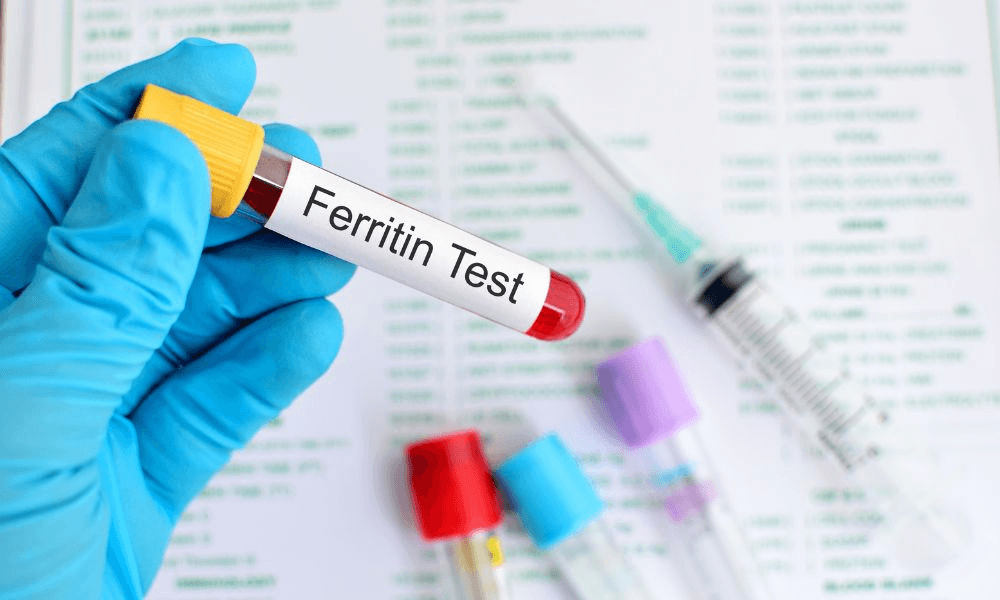 Ferritin Test in Women: Causes of Low Iron Stores Despite a Healthy Diet