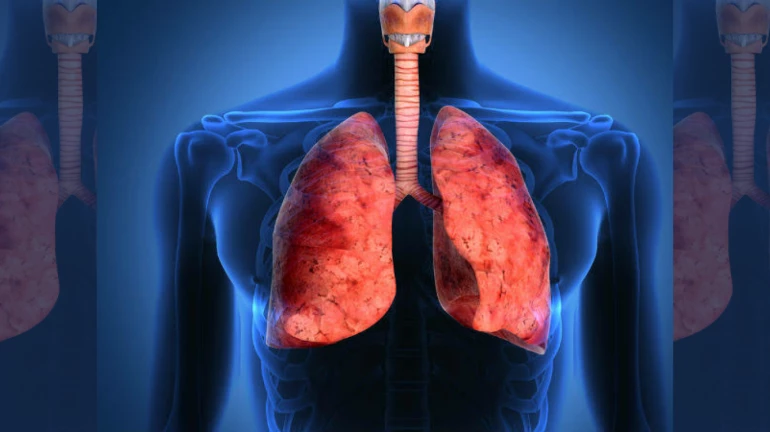 Unhealthy lifestyle & Air Pollution causes 1000 deaths every year in Mumbai Unhealthy lifestyle & Air Pollution causes 1000 deaths every year in Mumbai