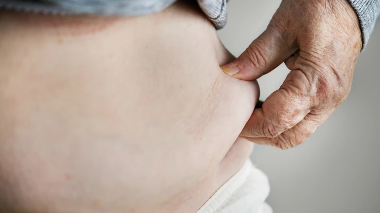 Mumbai Expert Urges Citizens to Cut Down on Sugar, Salt, and Oil to Tackle Obesity and Lifestyle Diseases Mumbai Expert Urges Citizens to Cut Down on Sugar, Salt, and Oil to Tackle Obesity and Lifestyle Diseases