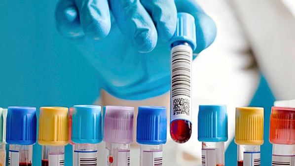 चालू वर्षात 382 लिटर रक्त वाया, रक्तपेढ्यांमधील भयानक स्थिती