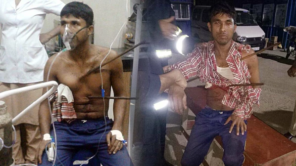 Iron rod pierces through a labourer at a construction site; survives post surgery 
