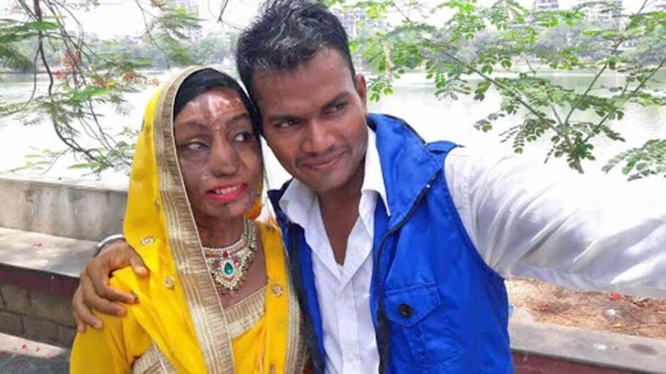 एसिड पिड़ितों  के फोटो का इस्तेमाल कर एनजीओ ने की धोखाधड़ी !