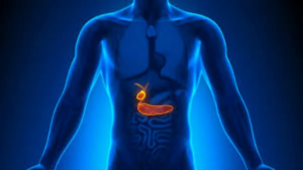 महिला के पित्ताशय की थैली से निकाले गए 284 स्टोन्स !