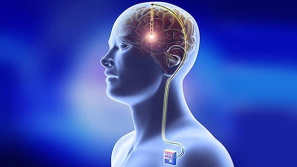 २ वर्षांनंतर 'त्यां'चा परतला आवाज, जसलोक रुग्णालयाची यशस्वी शस्त्रक्रिया