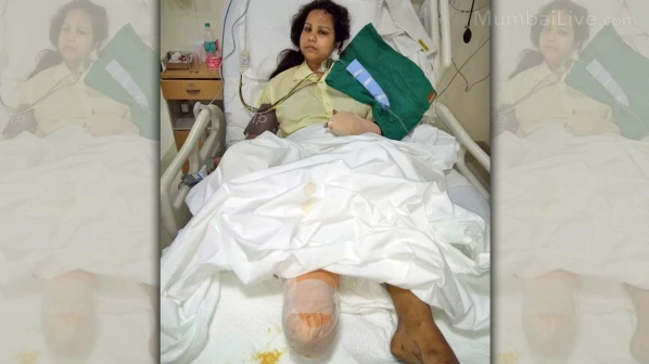 'मेरी क्या गलती थी जो मेरी ऐसी हालत हुई' पढ़िए 23 वर्षीय द्रविता की यह दर्दनाक दास्तां 