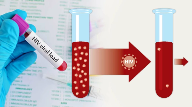 एचआयव्ही वायरल लोड चाचणीसाठी 'नॅको' आणि 'मेट्रोपोलीस' हेल्थकेअर एकत्र