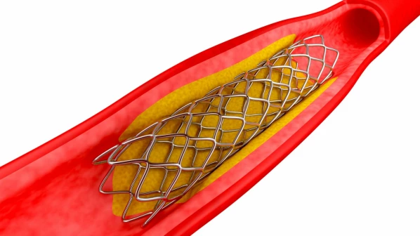 Relief to heart patients as NPPA caps stent prices