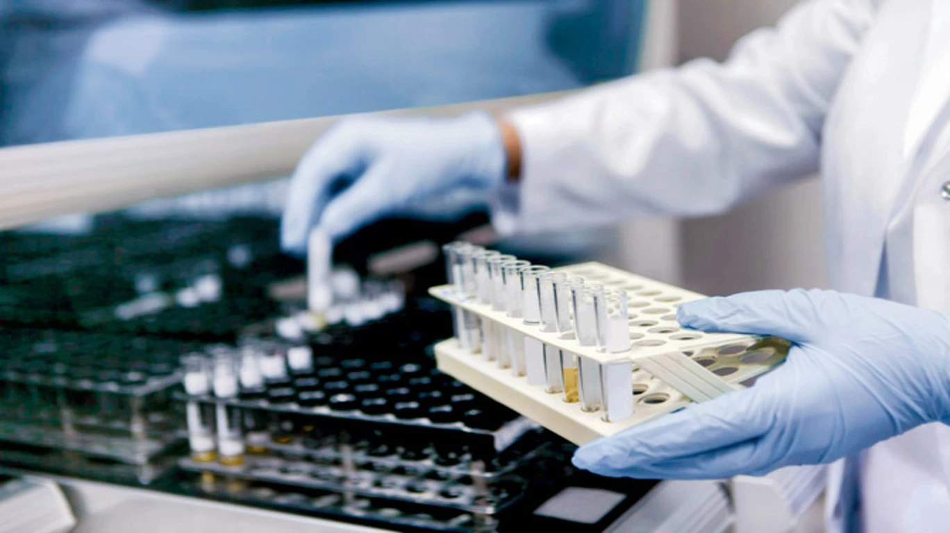 Mumbai to get five specialised labs and research centre to investigate Tuberculosis