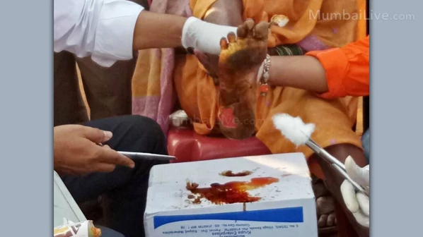 पायाच्या जखमेपेक्षा मनाची जखम मोठी, शेतकरी आजीची व्यथा