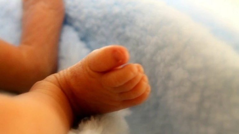 Newborn baby without Anus successfully treated at Mumbai Hospitals