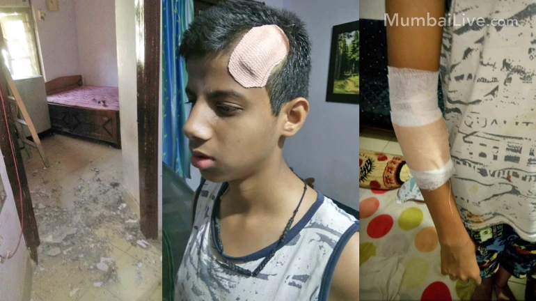 बांद्रा में एक घर का स्लैब का एक हिस्सा गिरने से 12 साल का लड़का जख्मी