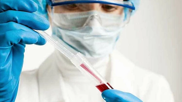 साथीरोग नियंत्रण कक्षासाठी आरोग्य विभागाचे प्रयत्न सुरू