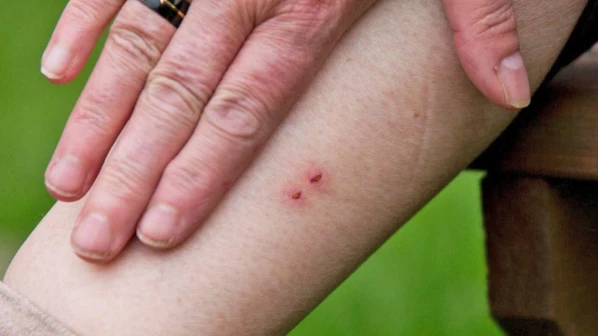 अँटी स्नेक औषधांचा प्रभाव कमी, मुंबईत आढळल्या १३३ केसेस