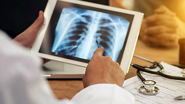 40 per cent of Tuberculosis cases are from Mumbai: Health Ministry Report