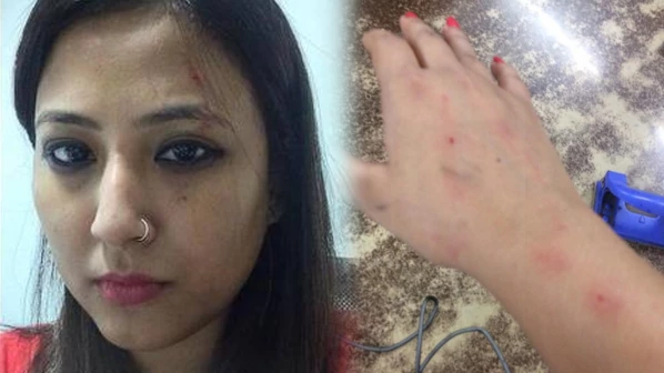 उबर कॅबमध्ये महिला पत्रकाराला मारहाण